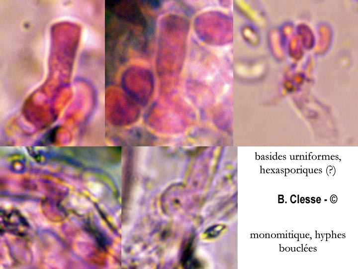Sistotrema porulosum