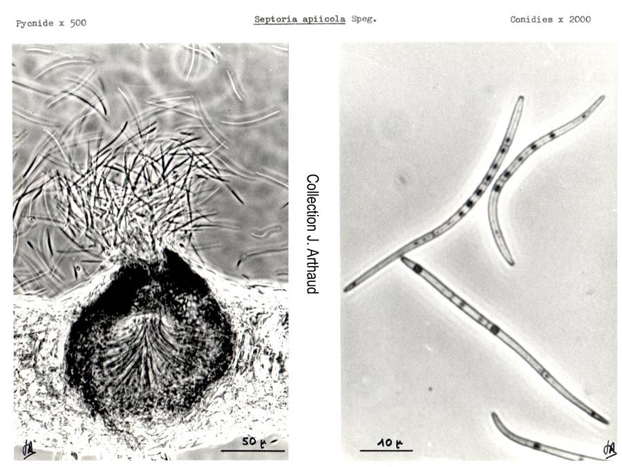 Septoria apiicola