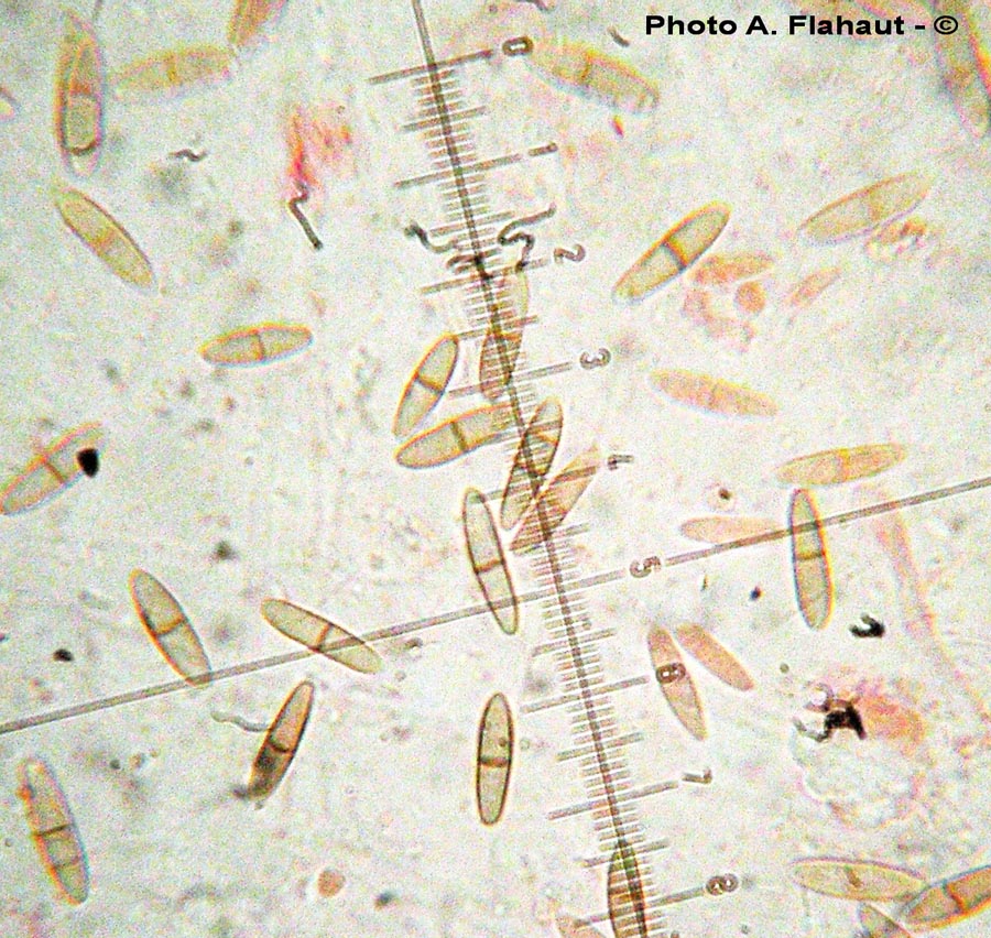 Ascochyta hordeicola