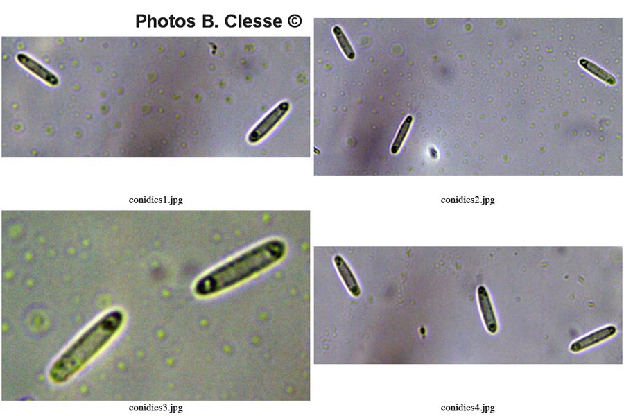 Ceuthospora hederae