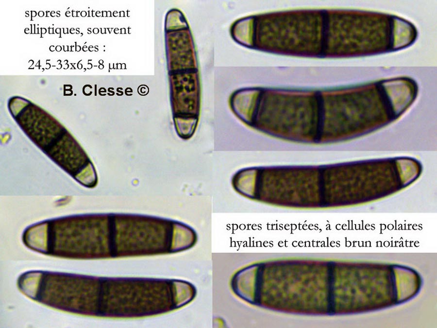 Chaetosphaerella phaeostroma