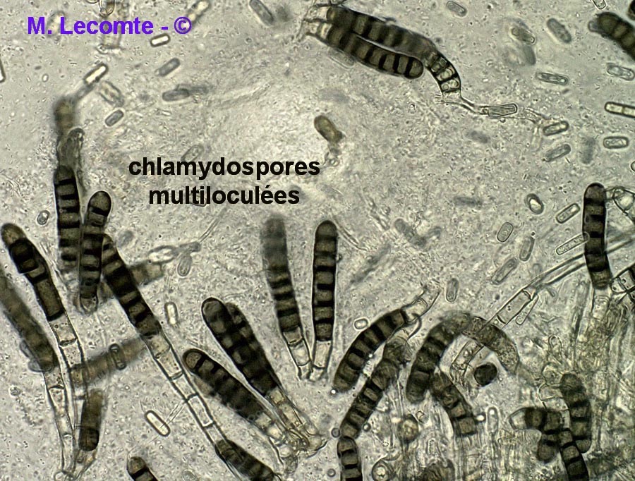 Chalaropsis thielavioides (Ceratocystis paradoxa)