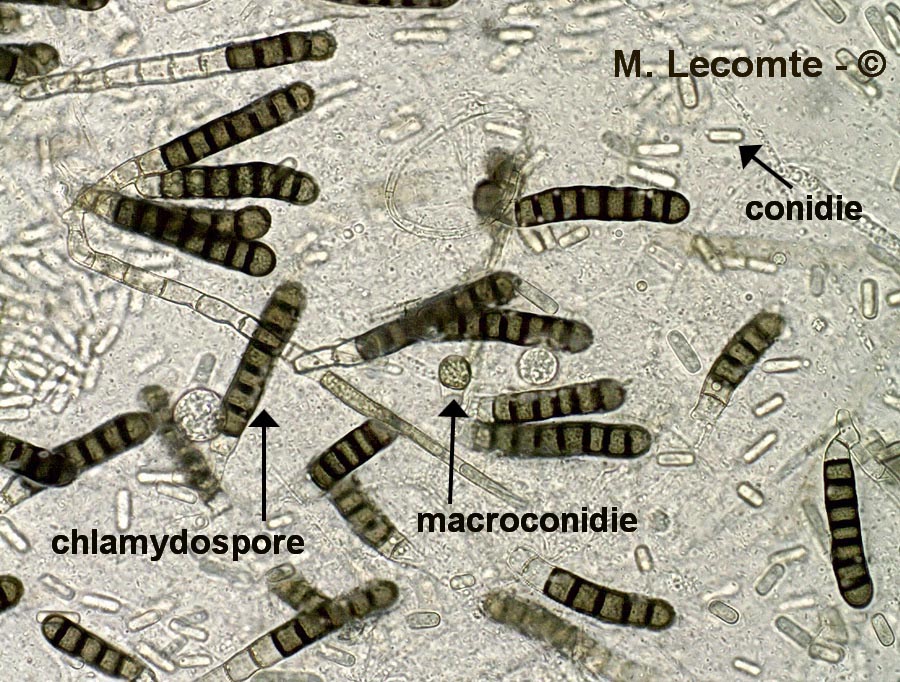 Chalaropsis thielavioides (Ceratocystis paradoxa)