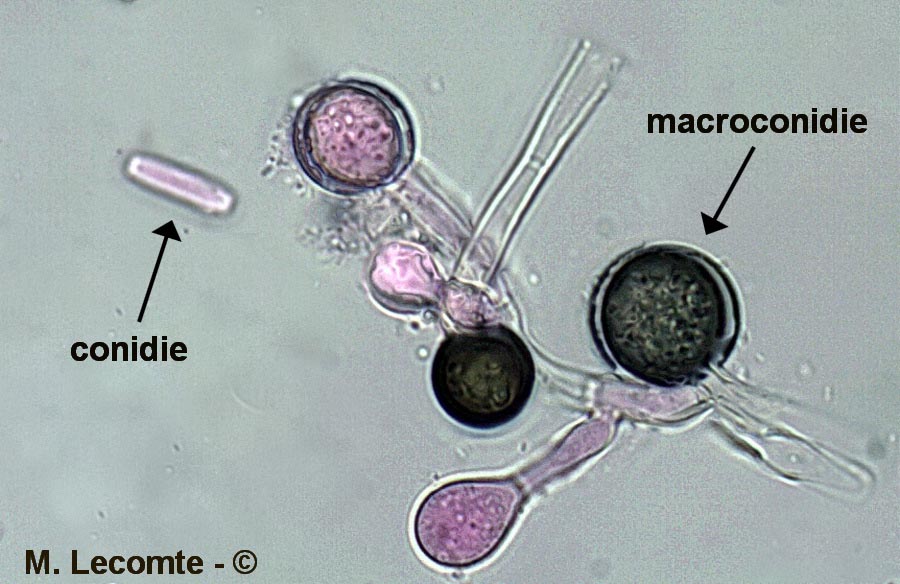 Chalaropsis thielavioides (Ceratocystis paradoxa)