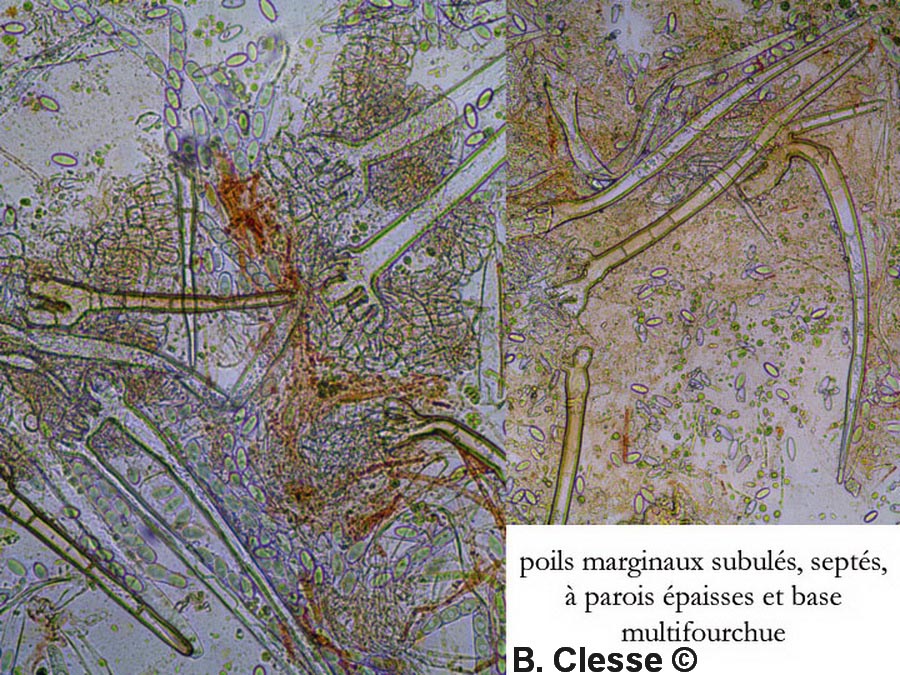 Cheilymenia stercorea