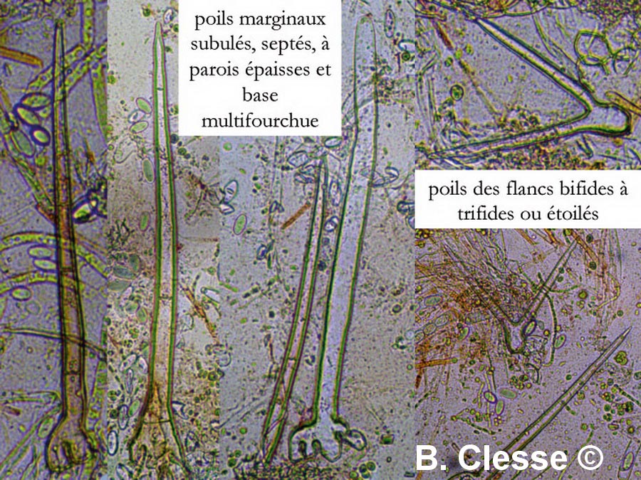 Cheilymenia stercorea