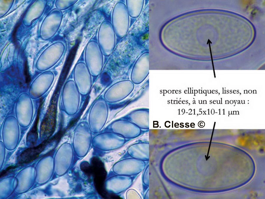 Cheilymenia stercorea