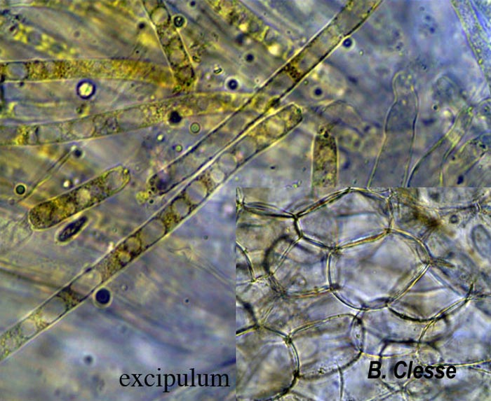 Cheilymenia theleboloides