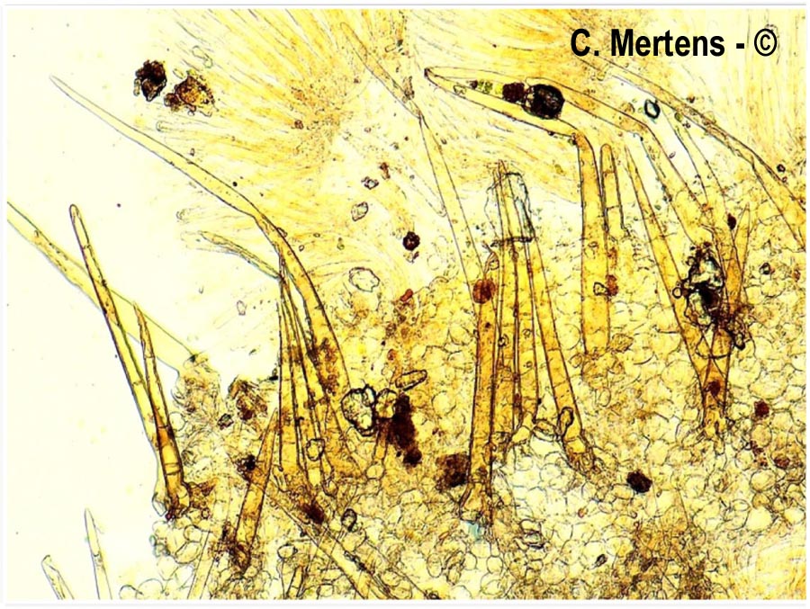Cheilymenia vitellina