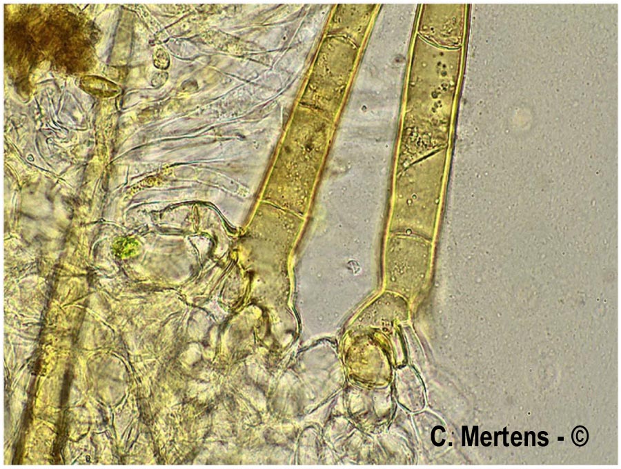 Cheilymenia vitellina