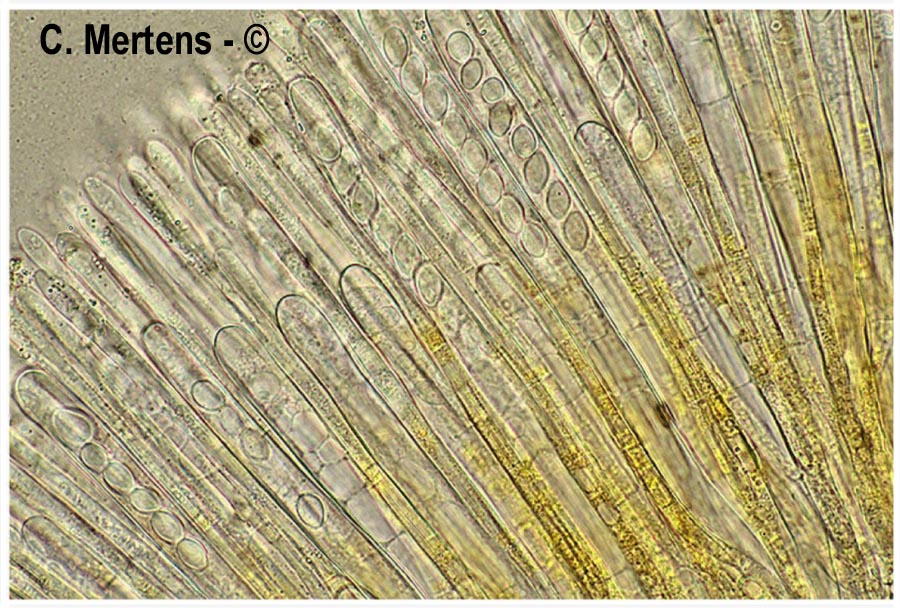 Cheilymenia vitellina
