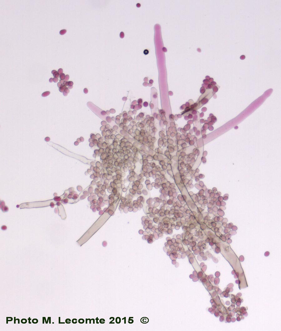 Cladosporium sp.