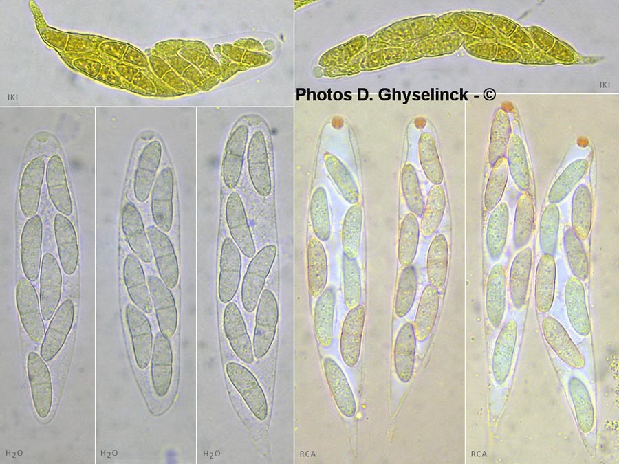 Cryptodiaporthe salicina