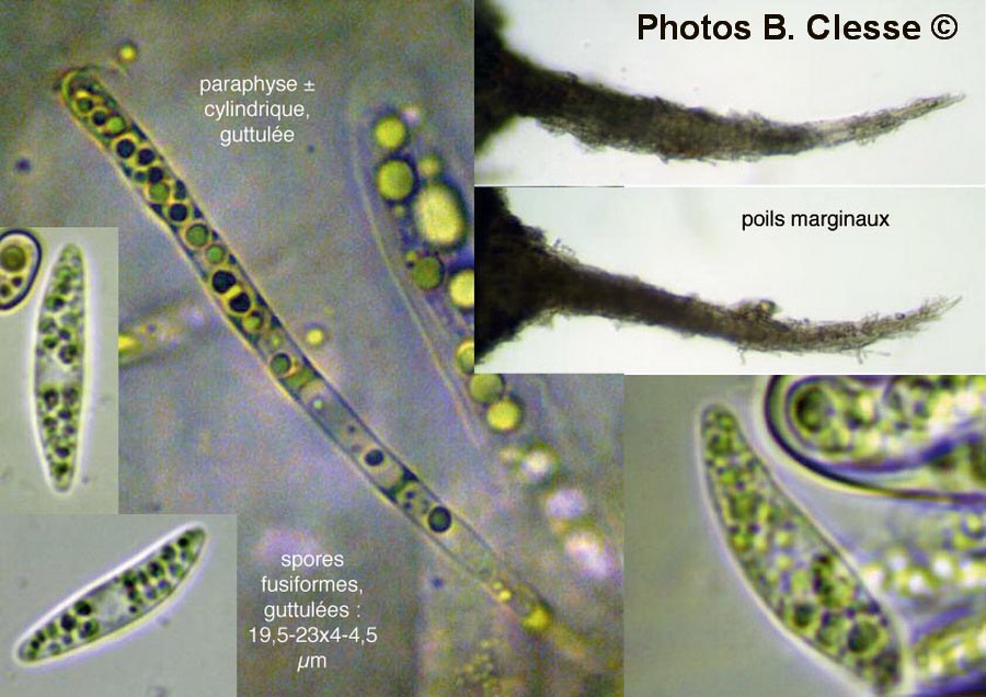 Cyathicula coronata (Crocicreas coronatum)