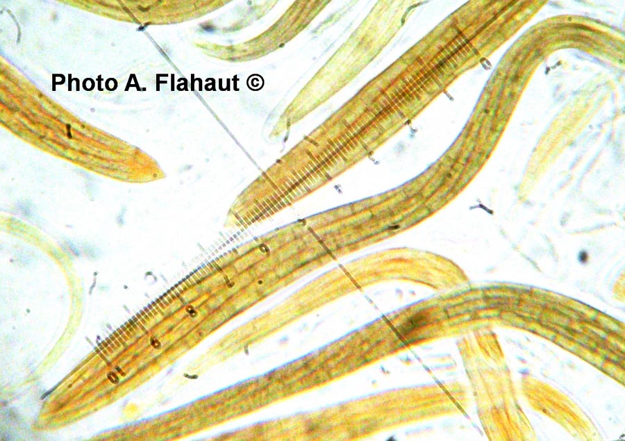 Gaeumannomyces graminis