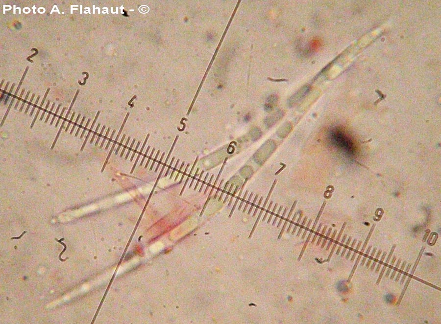 Gaeumannomyces graminis