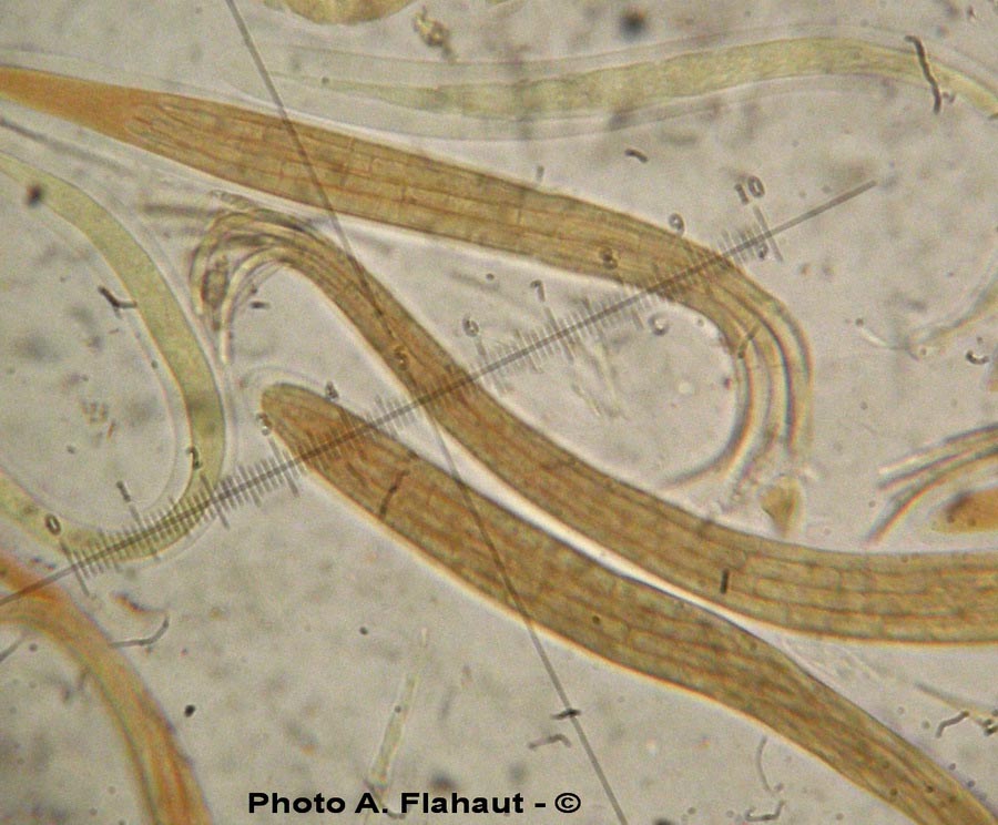 Gaeumannomyces graminis