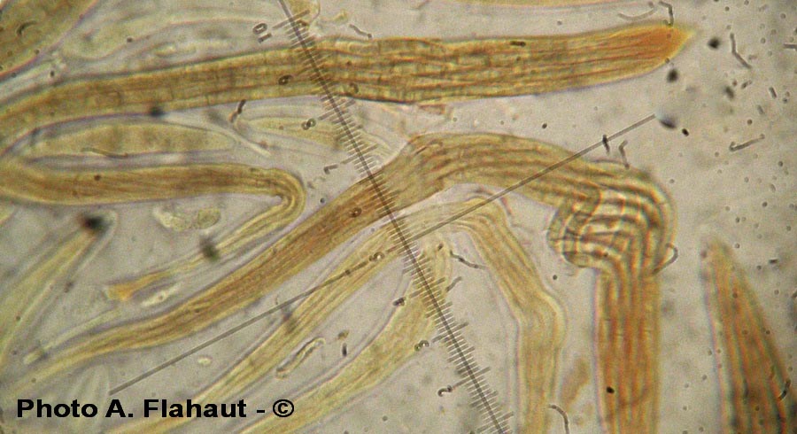 Gaeumannomyces graminis