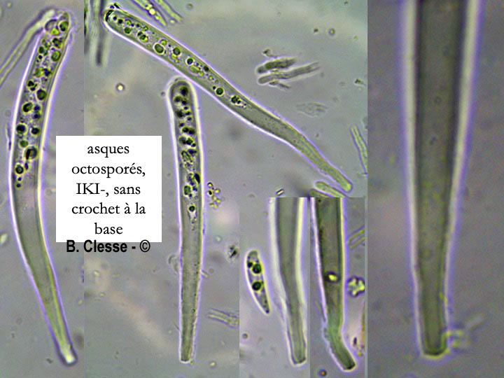 Hymenoscyphus carpini