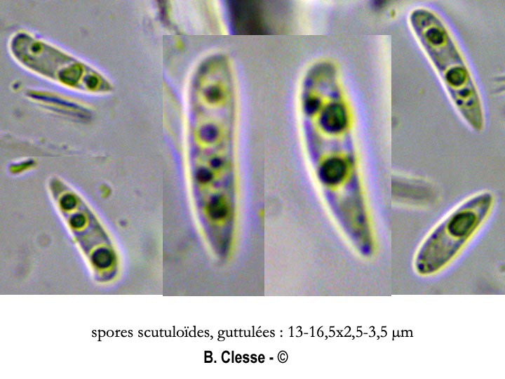 Hymenoscyphus carpini