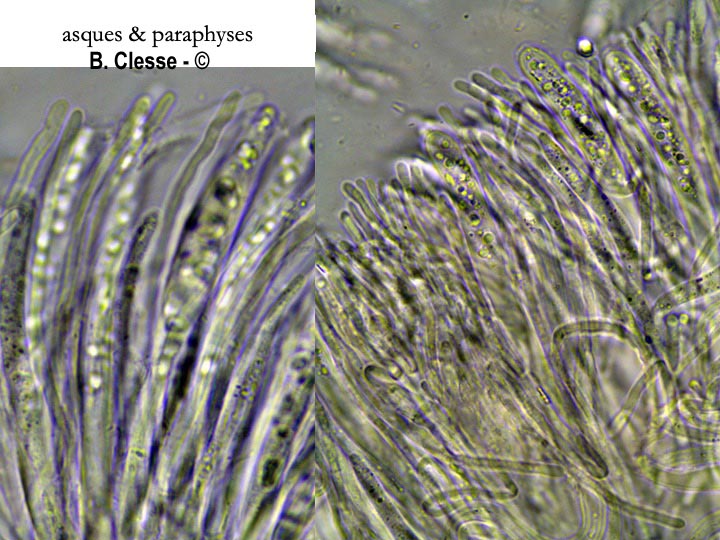 Hymenoscyphus carpini