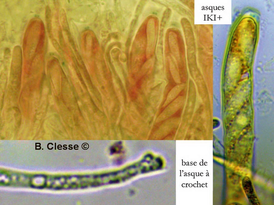 Hymenoscyphus conscriptus