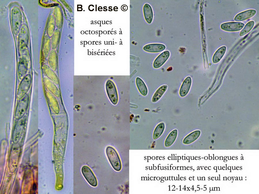 Hymenoscyphus conscriptus