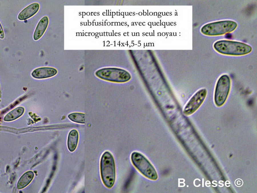 Hymenoscyphus conscriptus