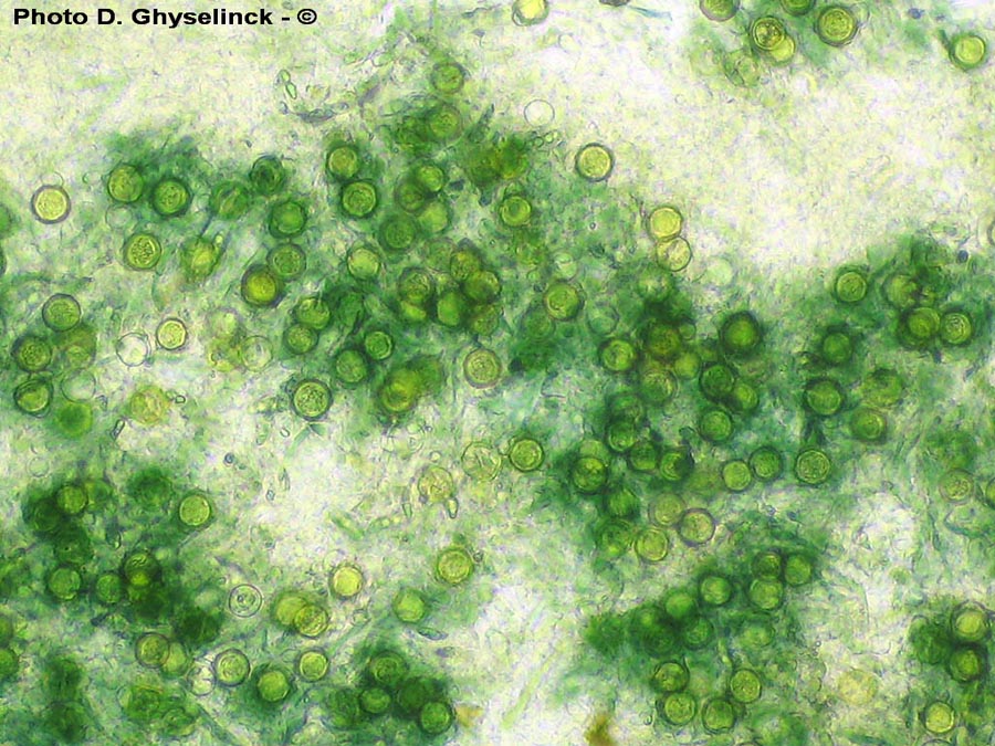 Hypomyces leotiicola