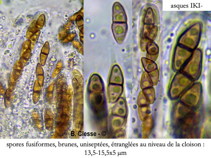 Immotthia atrograna