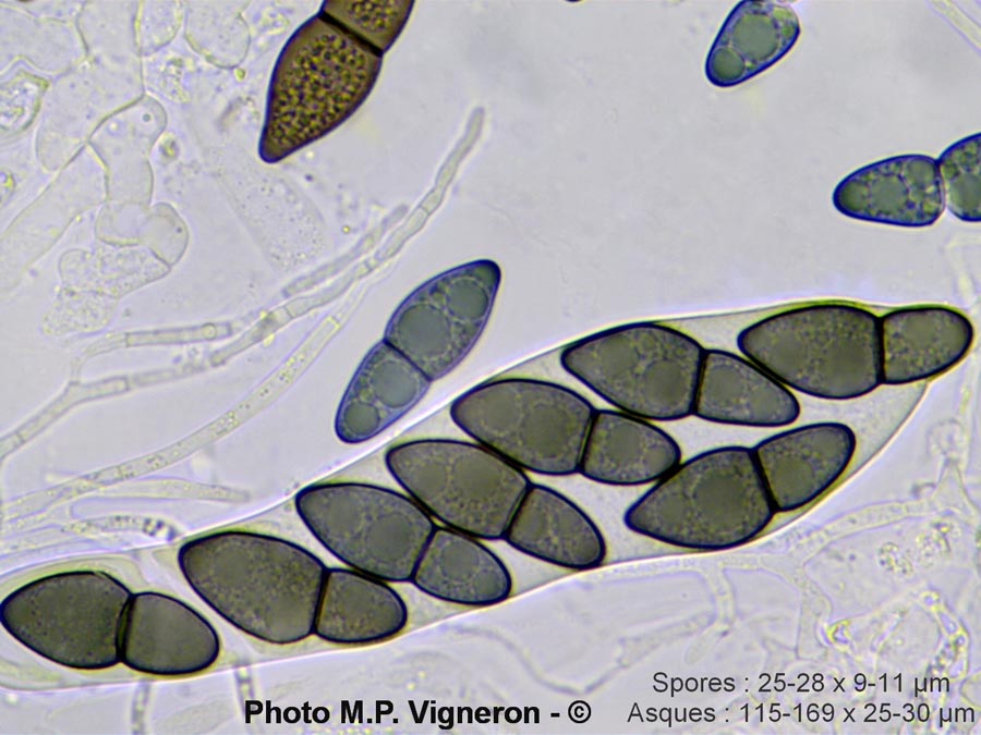 Kirschsteiniothelia aethiops