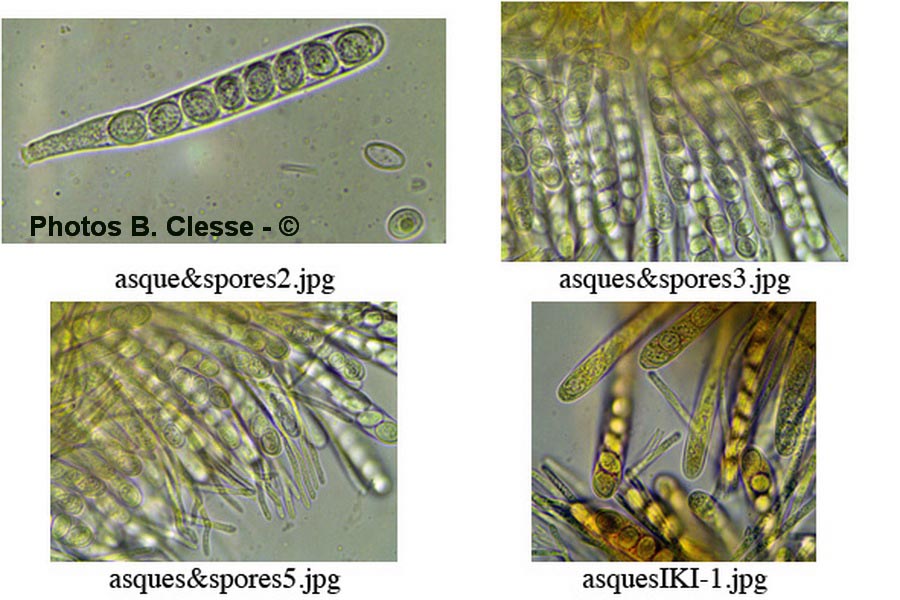 Lachnellula gallica