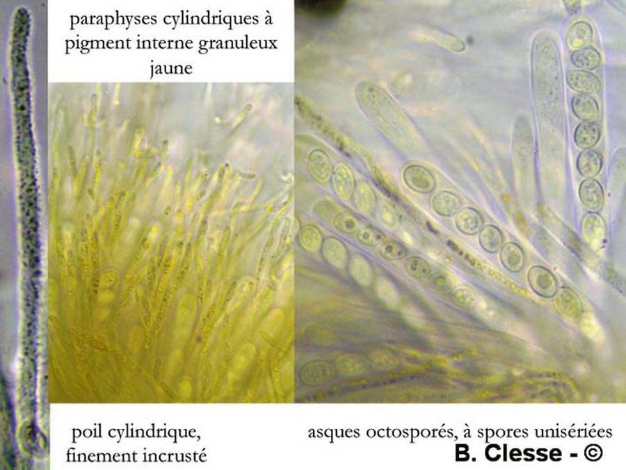 Lachnellula gallica