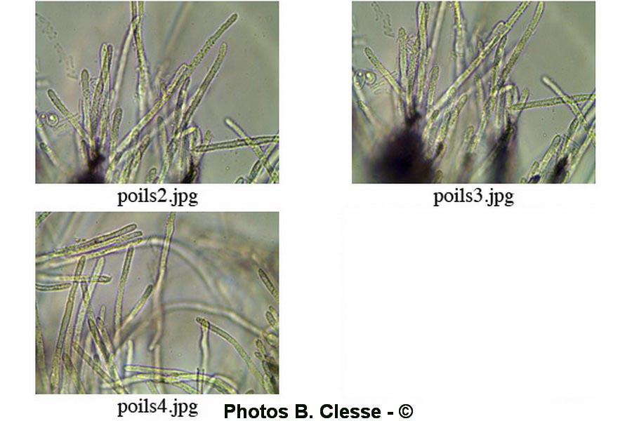 Lachnellula gallica