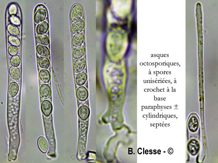 Lachnellula gallica