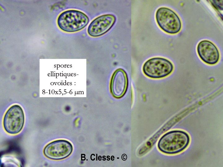 Lachnellula gallica