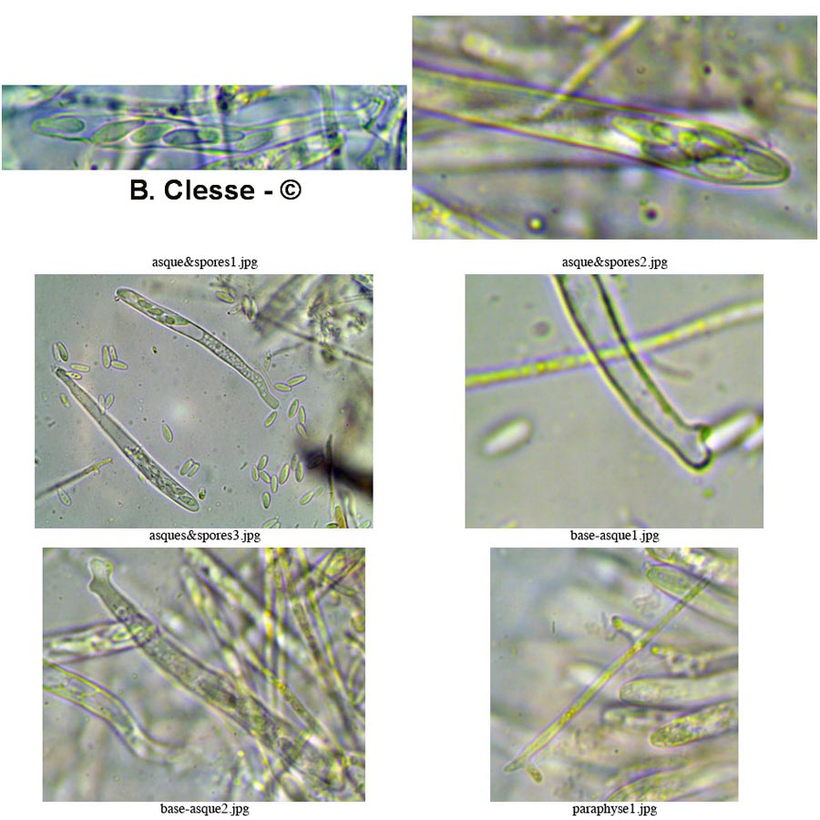 Lachnellula subtilissima