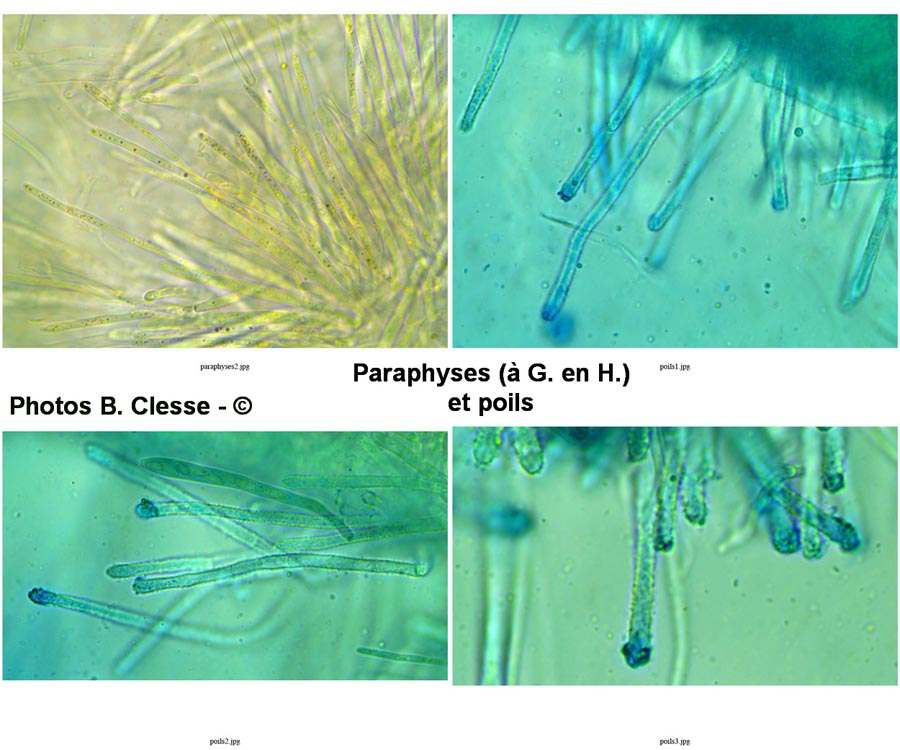 Lachnellula subtilissima