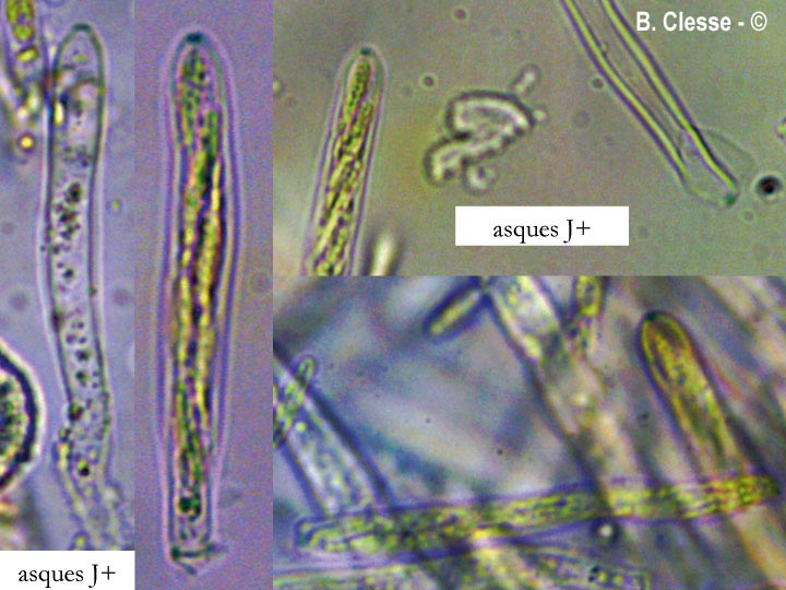 Lasiobelonium nidulus (Trichopezizella nidulus)