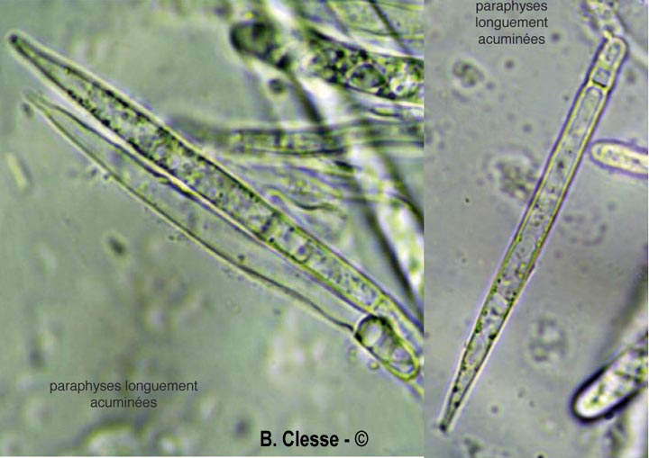 Lasiobelonium nidulus (Trichopezizella nidulus)