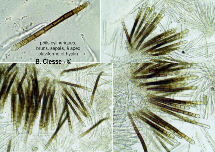 Lasiobelonium nidulus (Trichopezizella nidulus)