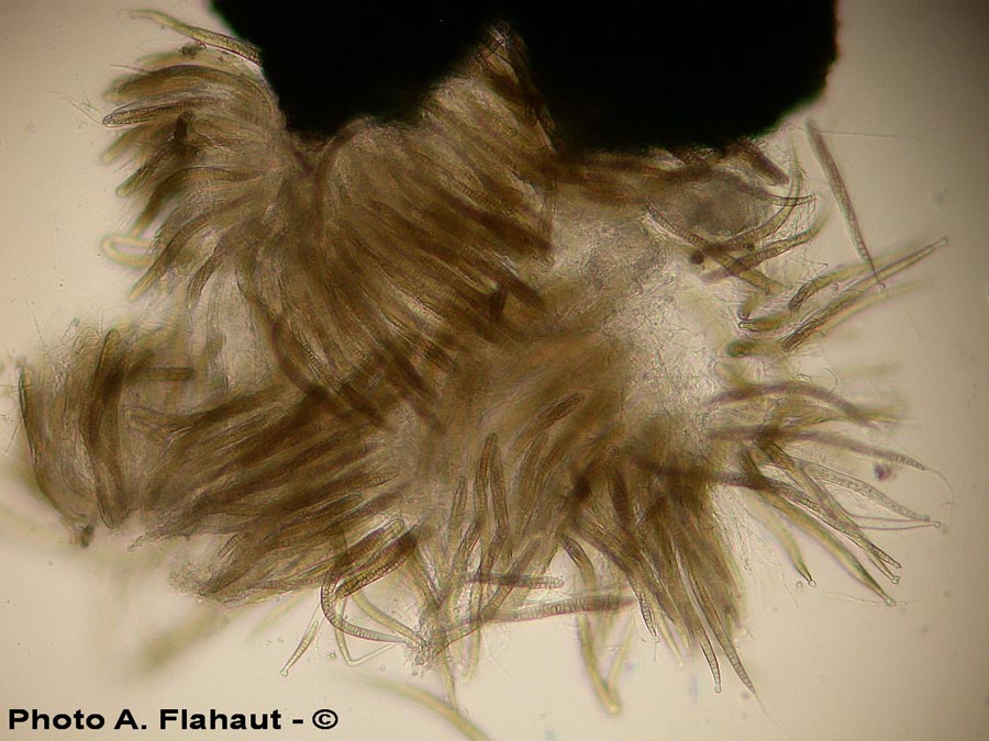 Leptosphaeria acuta