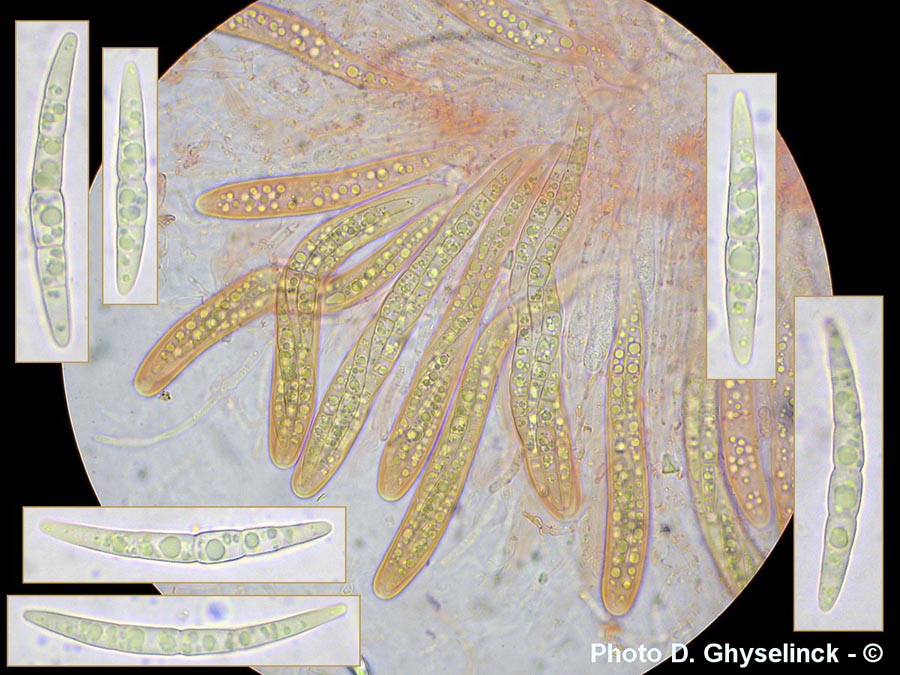 Leptosphaeria maculans