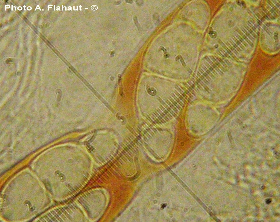 Leptosphaeria pelagica