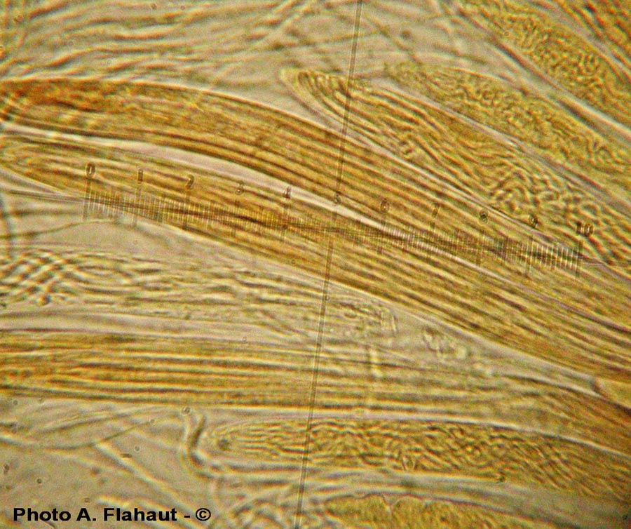 Lophiodermium conigenum