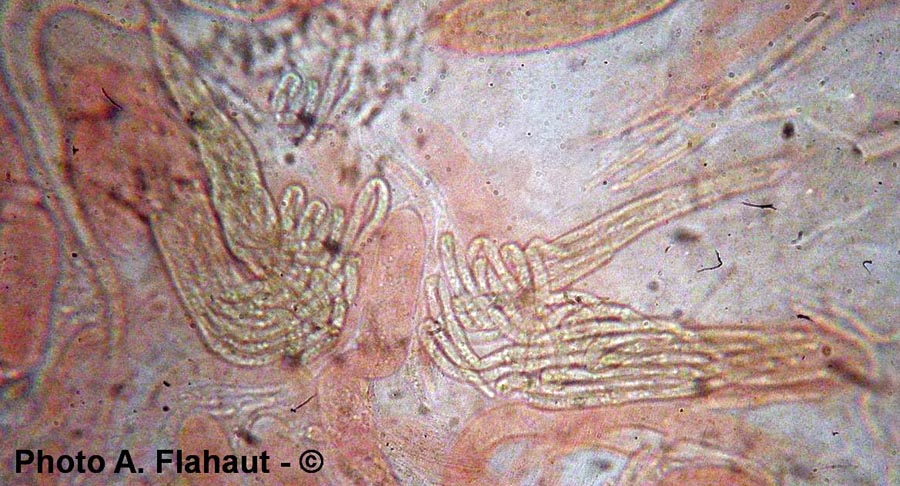 Ophiobolus ulnosporus
