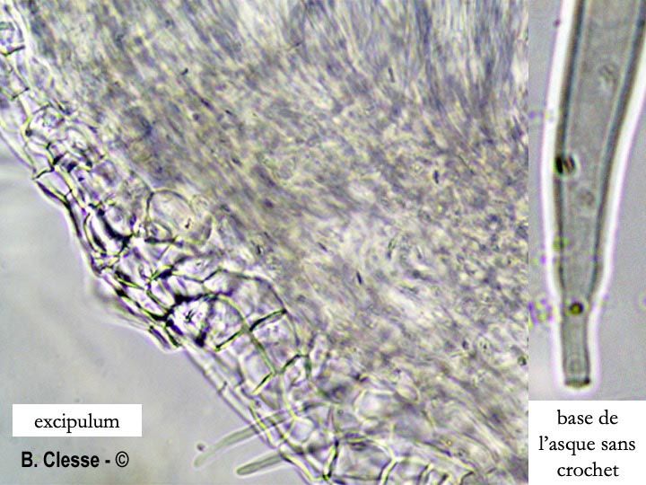 Phaeohelotium geogenum (Hymenoscyphus geogenum)