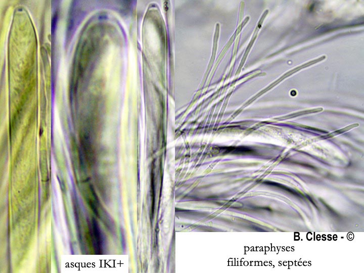 Phaeohelotium geogenum (Hymenoscyphus geogenum)