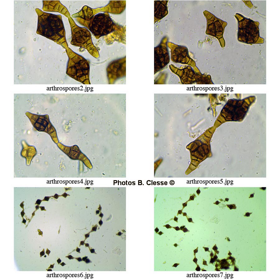 Phragmotrichum chailletii