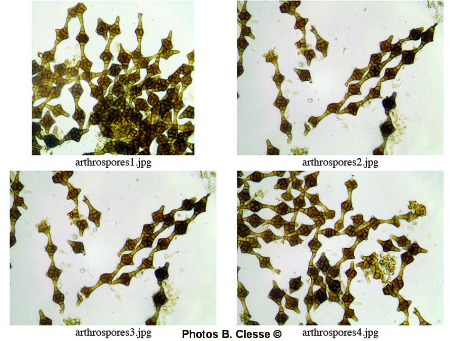 Phragmotrichum chailletii